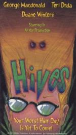 Hives