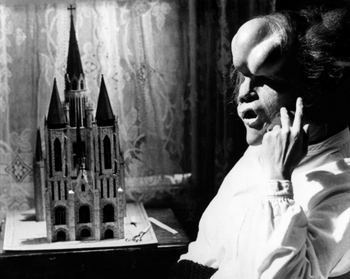 Фото - Человек-слон: 1200x957 / 200.8 Кб