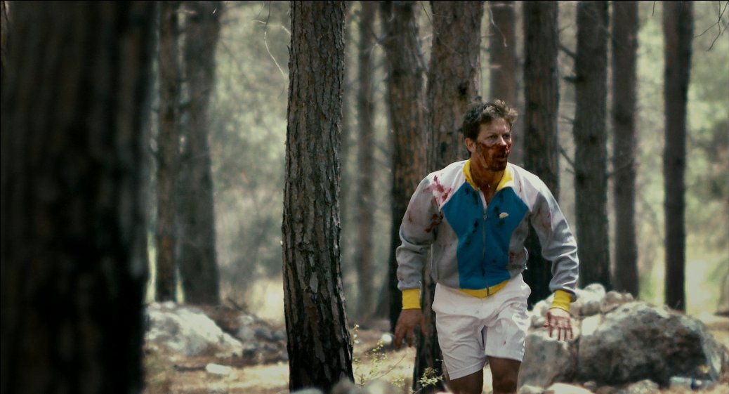 Фото - Бешенство: 1038x561 / 89 Кб